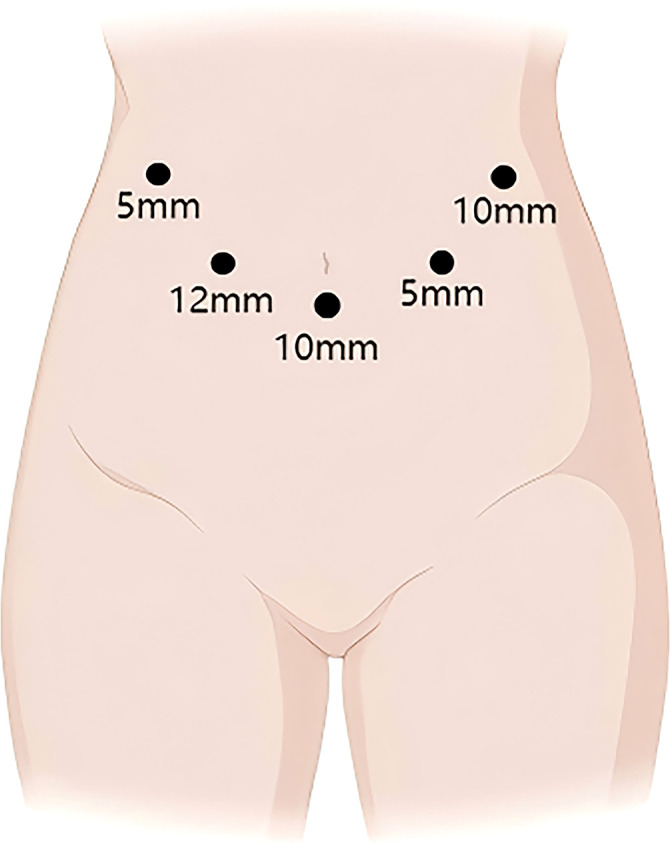 Figure 3