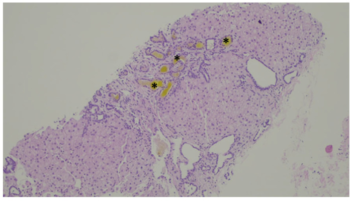 Figure 11