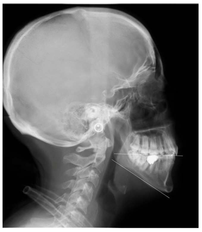 Figure 11