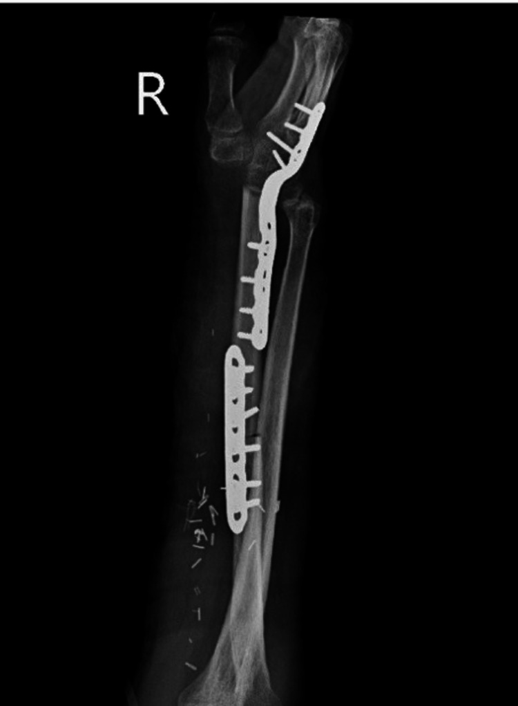 Figure 11