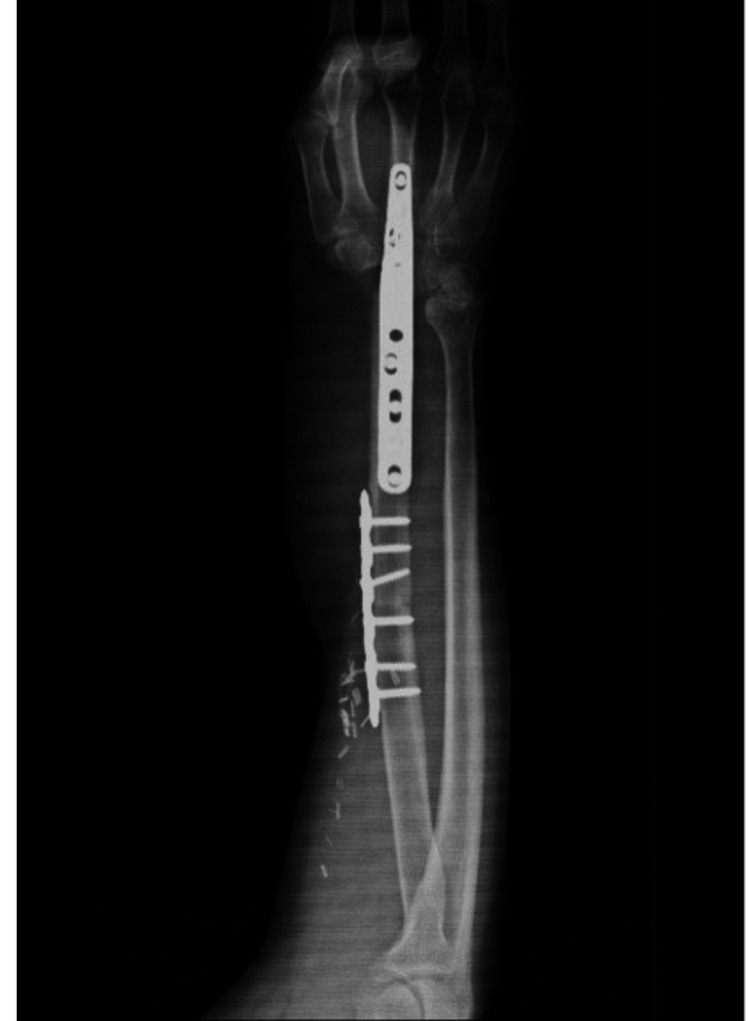 Figure 13