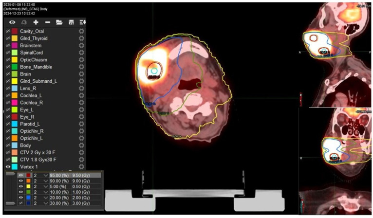 Figure 2