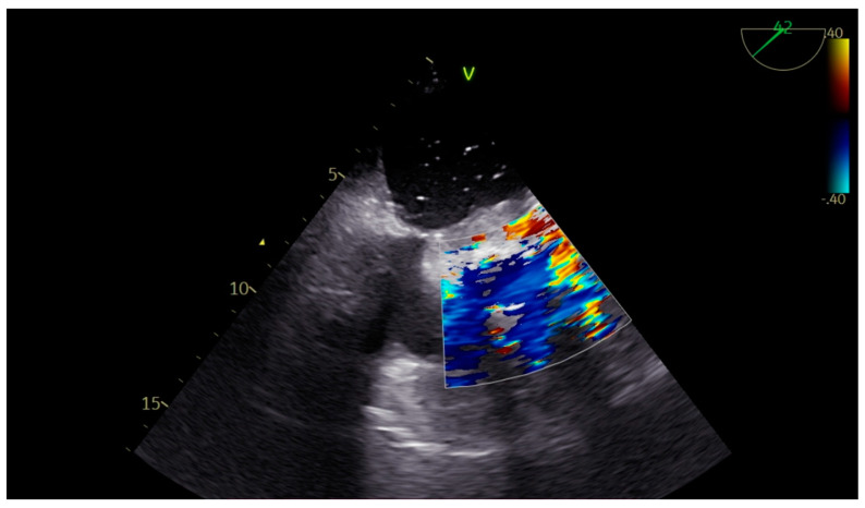 Figure 4