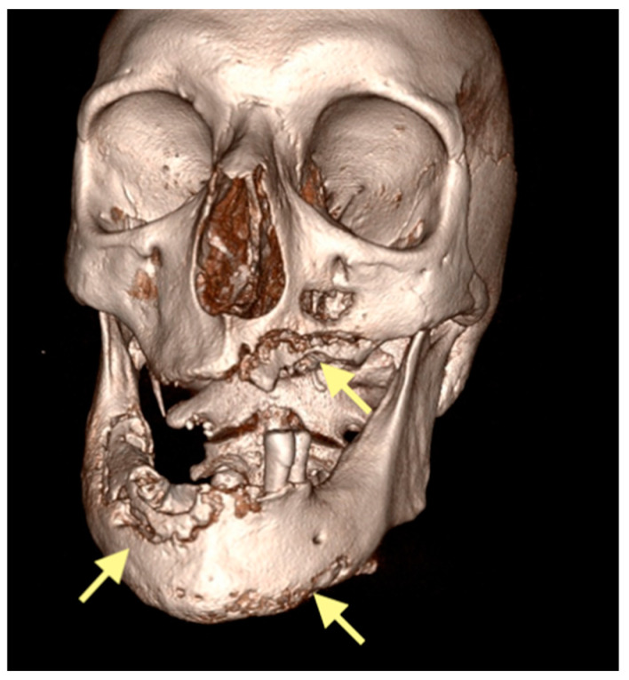 Figure 9