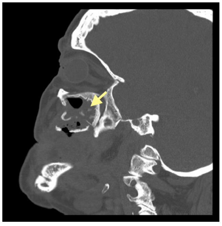 Figure 10