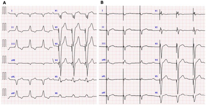 FIGURE 4
