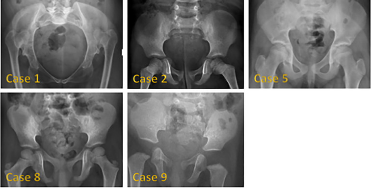 Figure 3