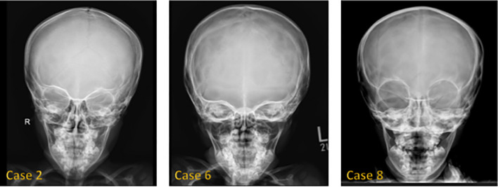 Figure 4