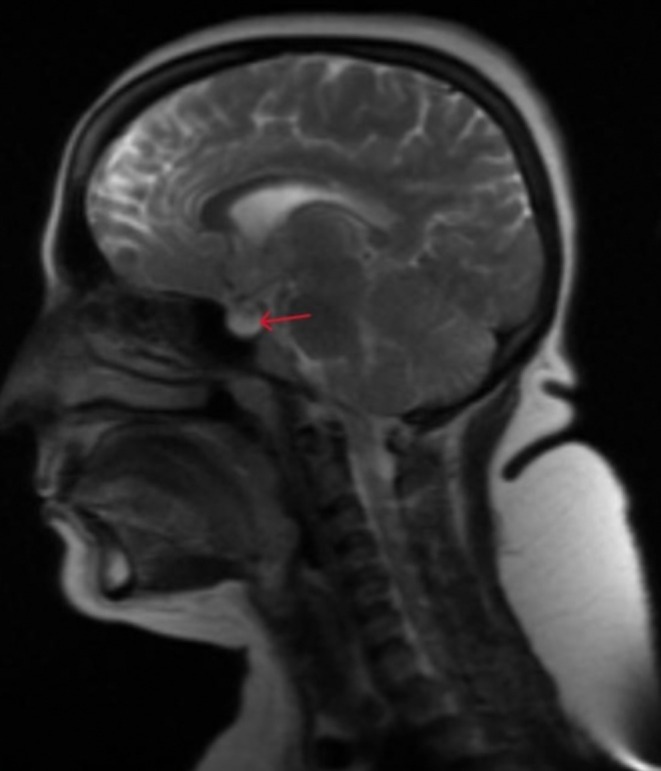 FIGURE 3