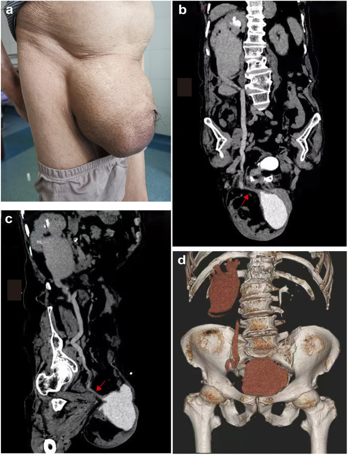 Figure 1