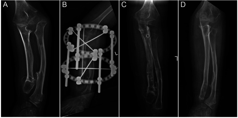 Figure 2