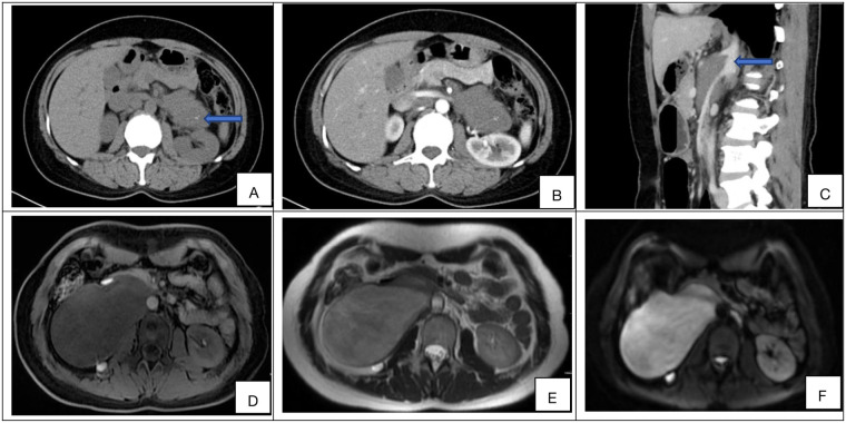 Figure 1