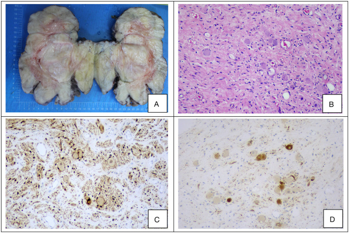 Figure 2