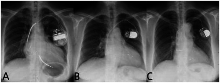 Figure 2