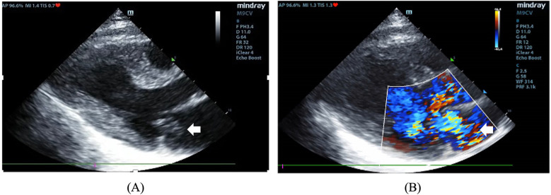 Figure 2