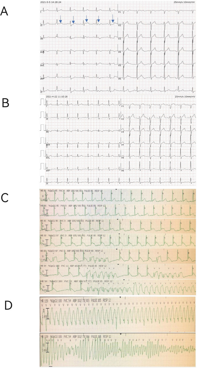 Figure 1