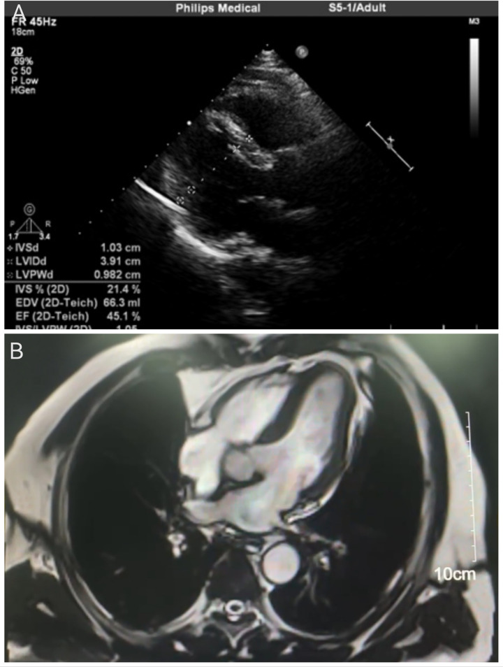 Figure 2