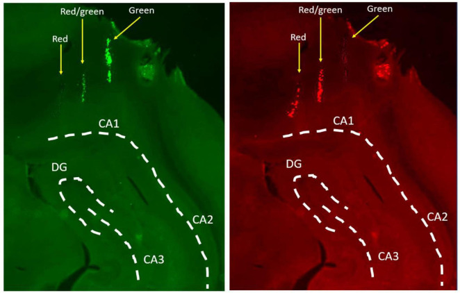 FIGURE 3