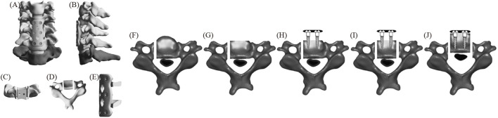 FIGURE 2