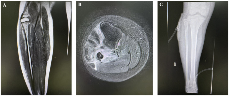 Figure 1