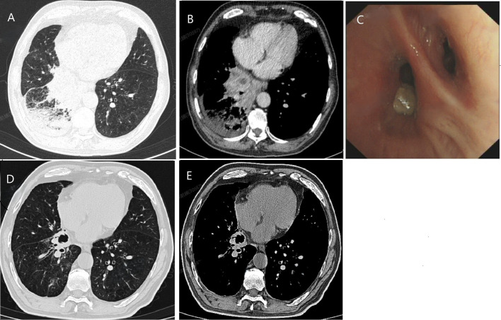 Figure 1