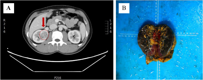 Figure 1