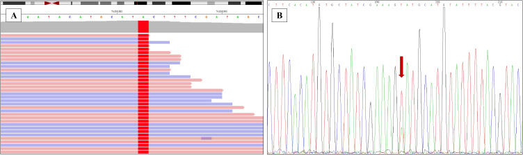 Figure 4