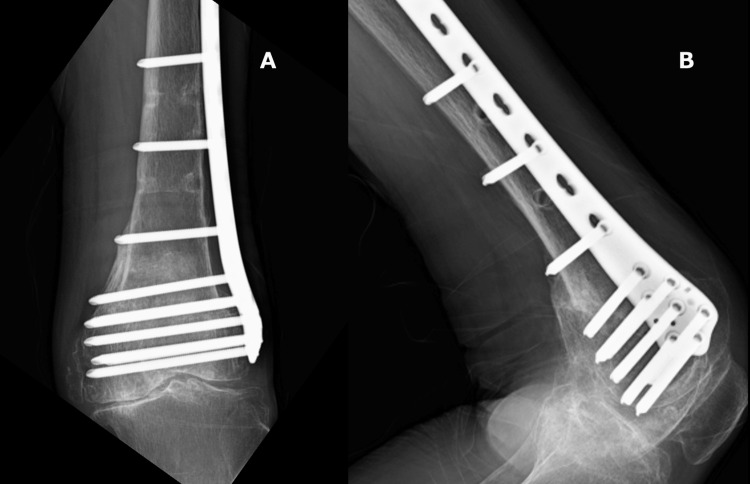 Figure 6
