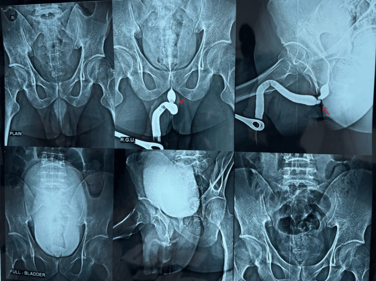 Figure 6