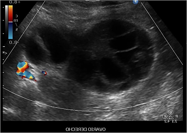 Figure 4