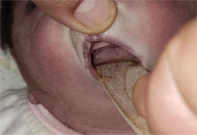 Figure 2