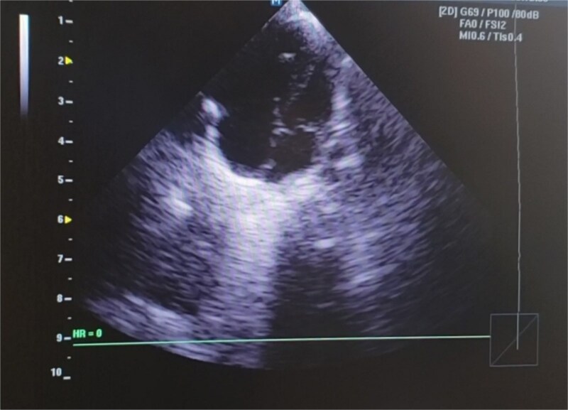 Figure 5