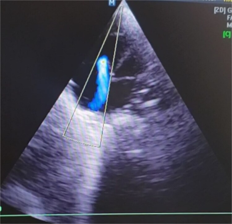 Figure 6