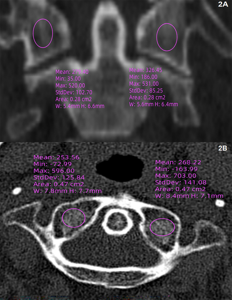 Figure 2