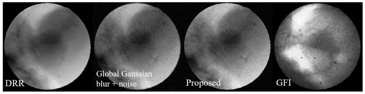 Figure 11