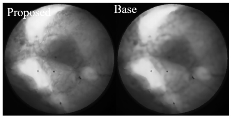 Figure 13