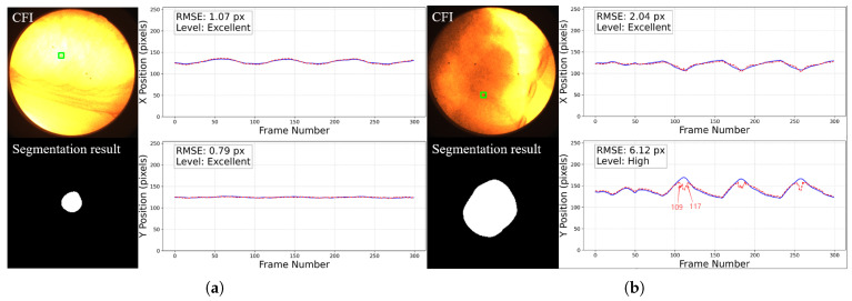 Figure 14