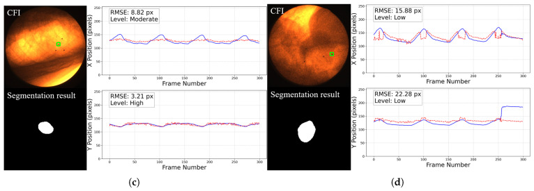 Figure 15