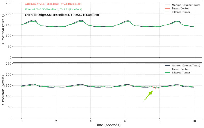 Figure 16