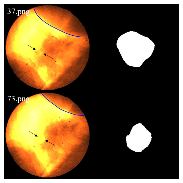 Figure 23