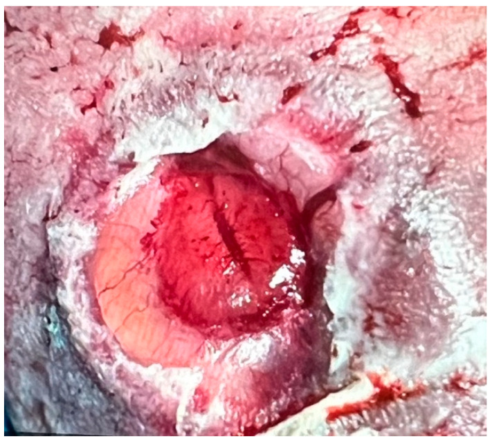 Figure 6