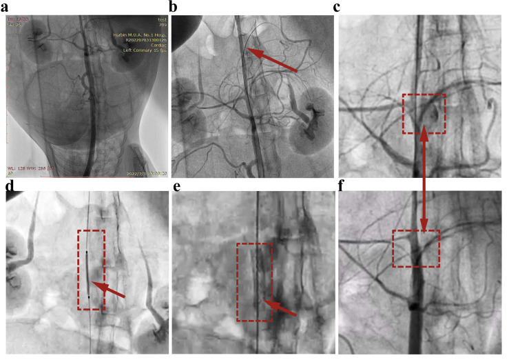 Figure 6