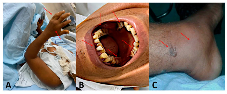 Figure 4