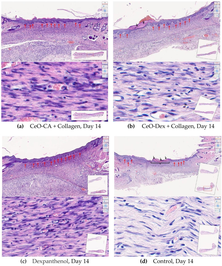 Figure 17