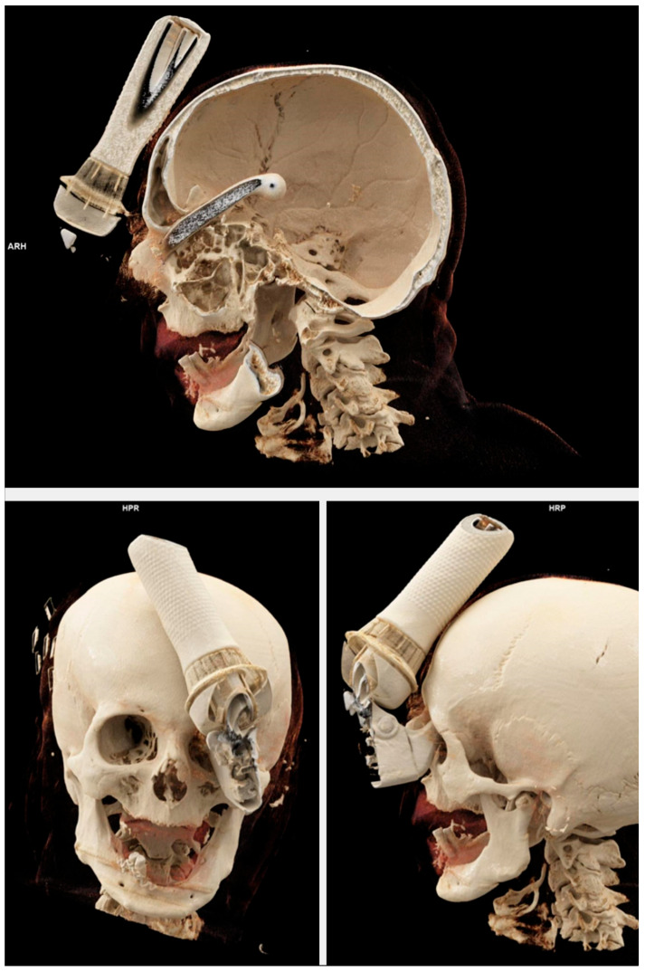 Figure 2