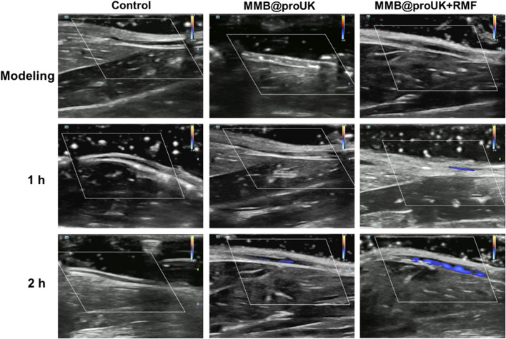 Figure 11