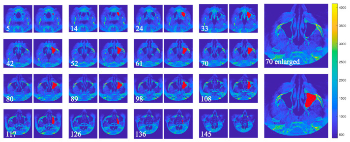 Figure 5