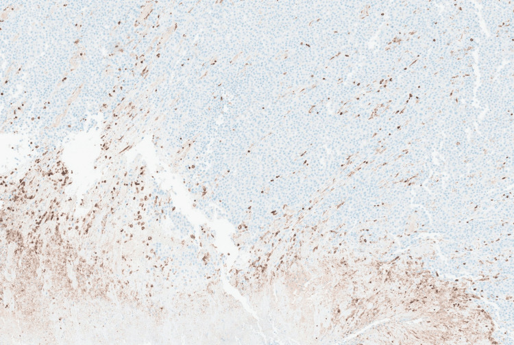 Figure 9