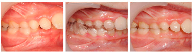 Figure 12