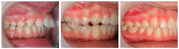 Figure 15